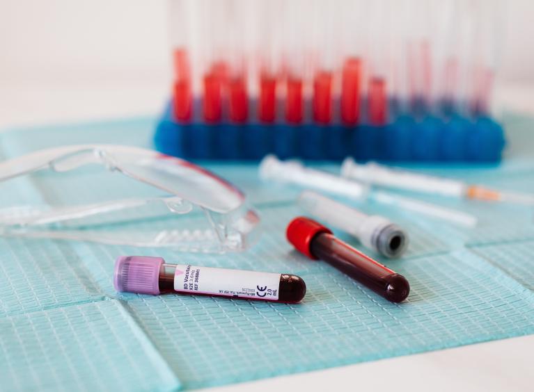 two vials of blood laying on a table