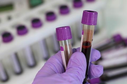 A person wearing PPE holds 2 test tubes which have blood samples in them, in a lab