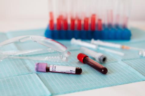 two vials of blood laying on a table